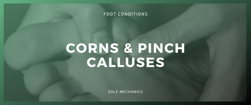 Corns & Pinch Calluses