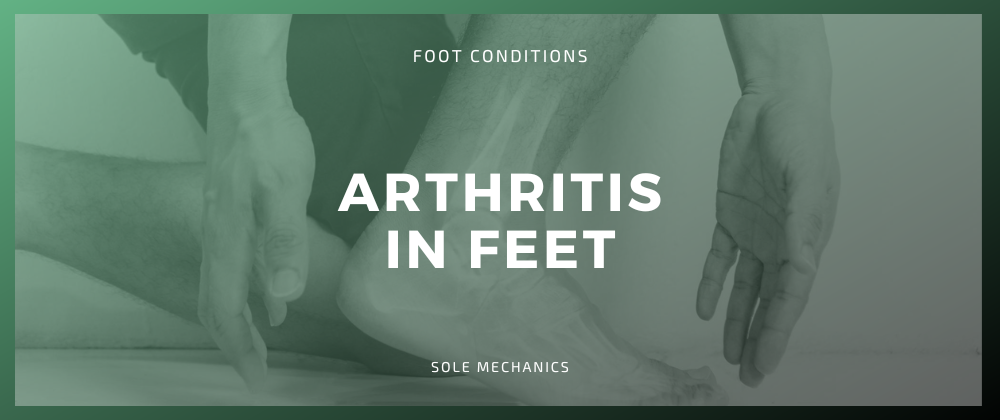Arthritis In Feet