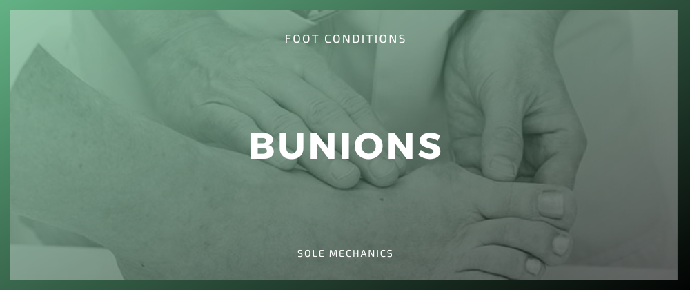 Bunions