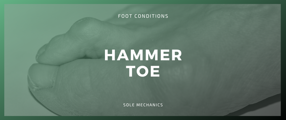 Hammer Toe